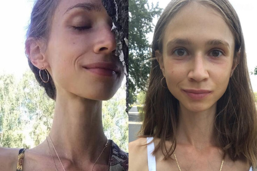 Ketika ditemui, Karolina hanya memiliki berat 22 kilogram.