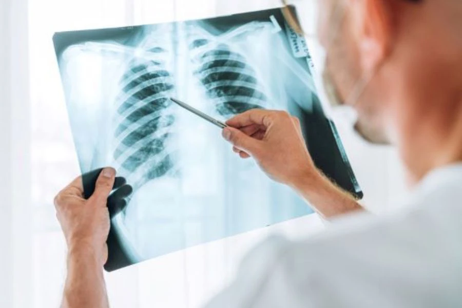 Sistem pencernaan bergiat aktif dan berisiko terdedah pada ganggu jika terus merokok.