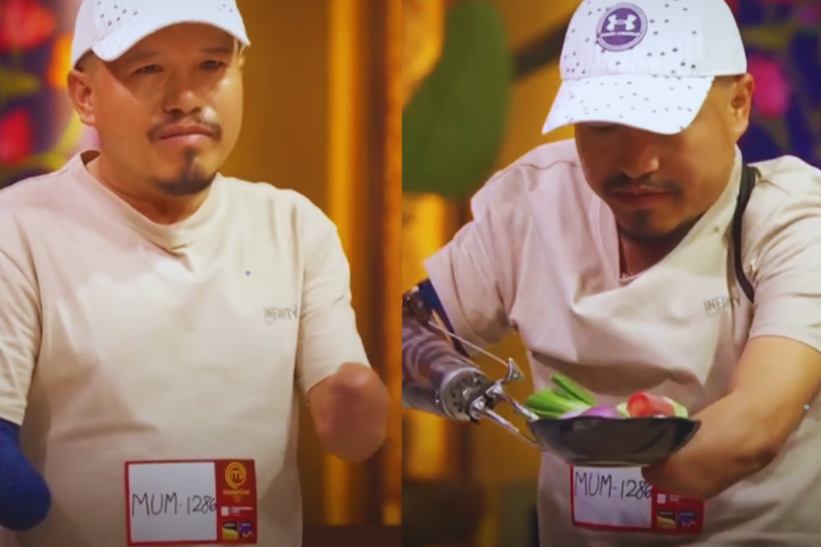 Kehilangan kedua belah tangan membuatkan Ratna melalui tempoh sukar dalam hidupnya.