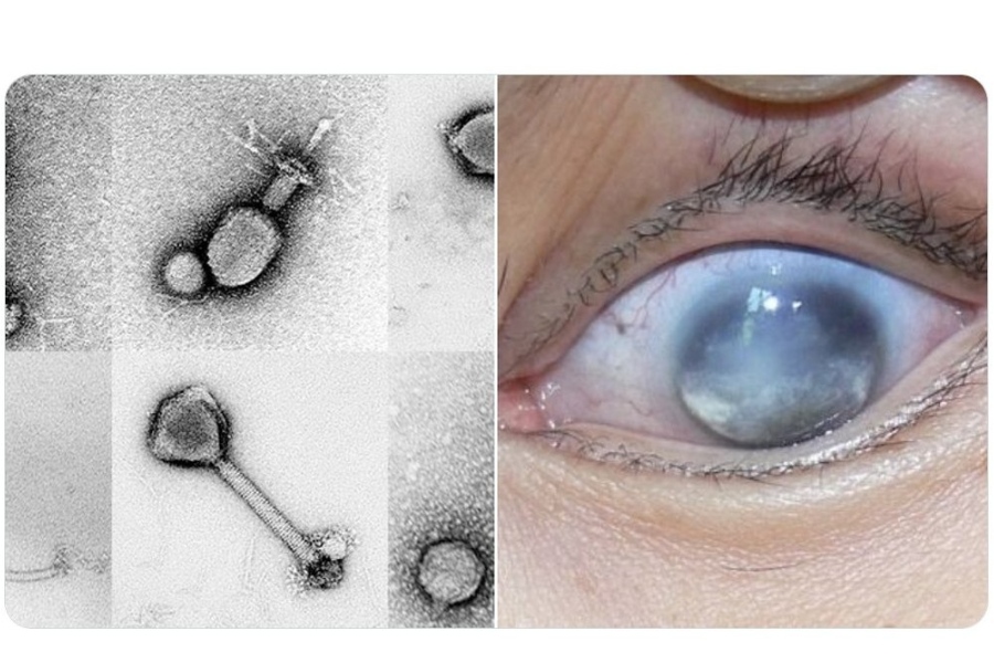 Virus Covert Mortality Nodavirus (CMNV) yang ditemui pada hidupan laut boleh menjejaskan mata.