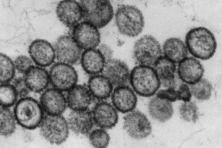Hantavirus dibawa oleh tikus liar.